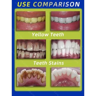 【新品未開封】歯石除去剤 歯のホワイトニング 歯の汚れの除去 口臭の除去 口臭 (歯磨き粉)