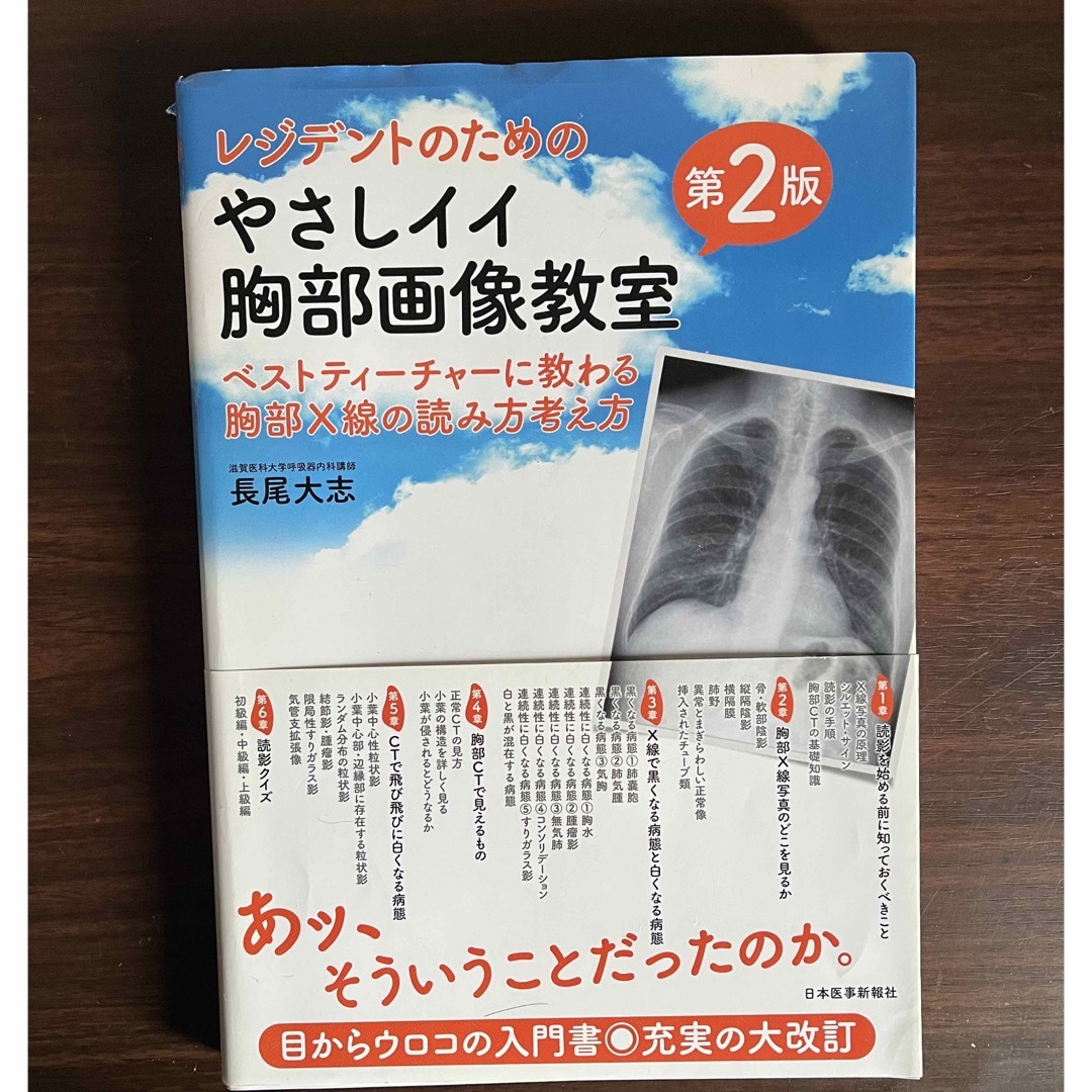 レジデントのためのやさしイイ胸部画像教室 エンタメ/ホビーの本(健康/医学)の商品写真