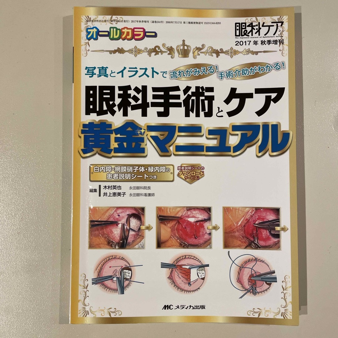 眼科手術とケア黄金マニュアル エンタメ/ホビーの本(健康/医学)の商品写真