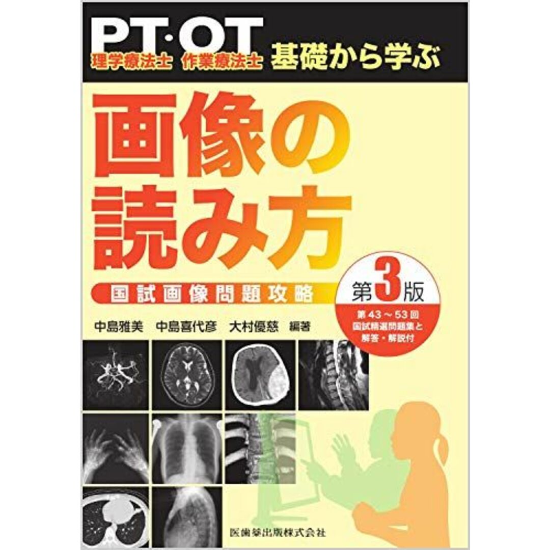 理学療法士・作業療法士 PT・OT基礎から学ぶ 画像の読み方 第3版 国試画像問題攻略 中島 雅美、 中島 喜代彦; 大村 優慈 エンタメ/ホビーの本(語学/参考書)の商品写真