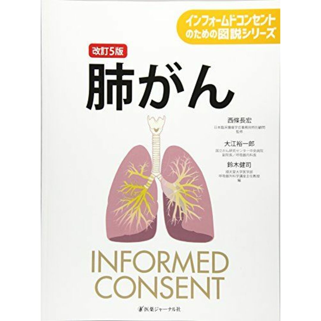 【500円引きクーポン】 肺がん (インフォームドコンセントのための図説シリーズ) 長宏, 西條、 裕一郎, 大江; 健司, 鈴木 語学+参考書