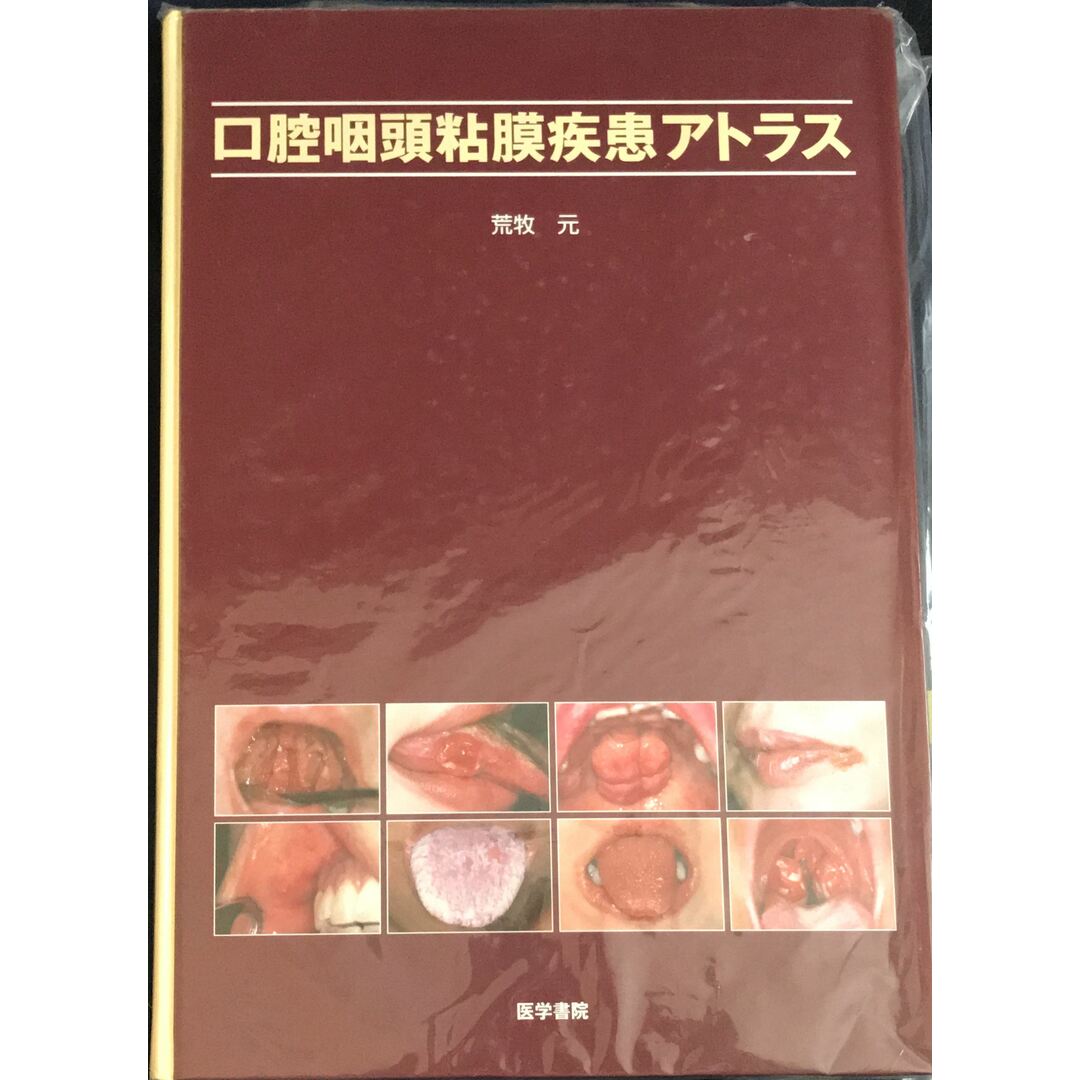 新しいコレクション 口腔咽頭粘膜疾患アトラス 荒牧 元 管理番号:20231205-2 その他