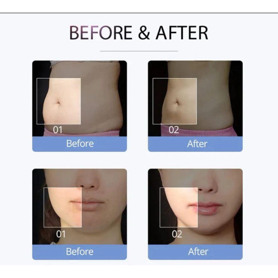 s-shape 業務用キャビテーション 30k EMS ラジオ波の通販 by s-shape 業務用キャビテーション 30k EMS ラジオ波の通販 by