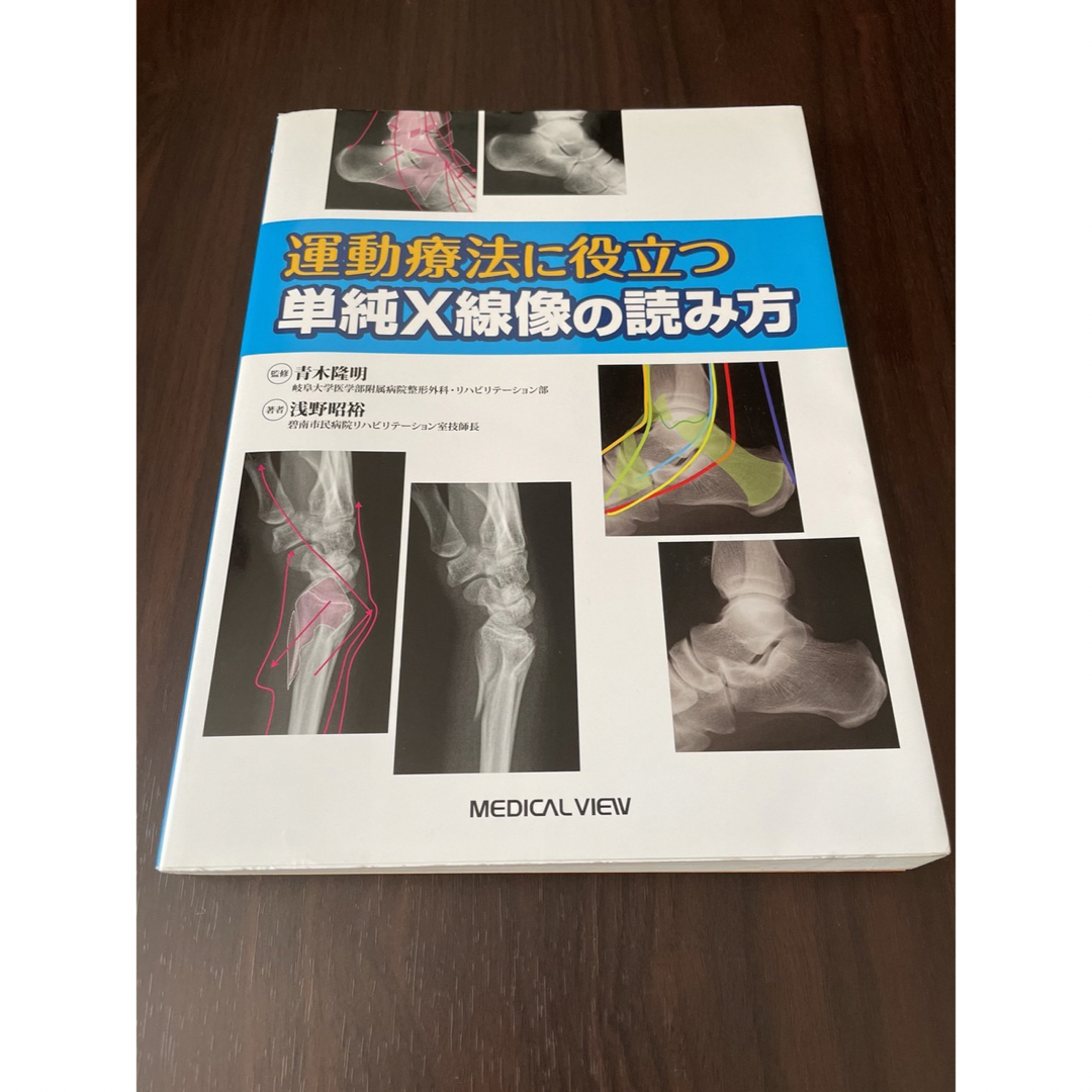 運動療法に役立つ単純X線像の読み方 - 健康・医学