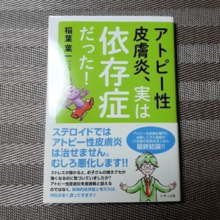 アトピー性皮膚炎、実は依存症だった！(健康/医学)