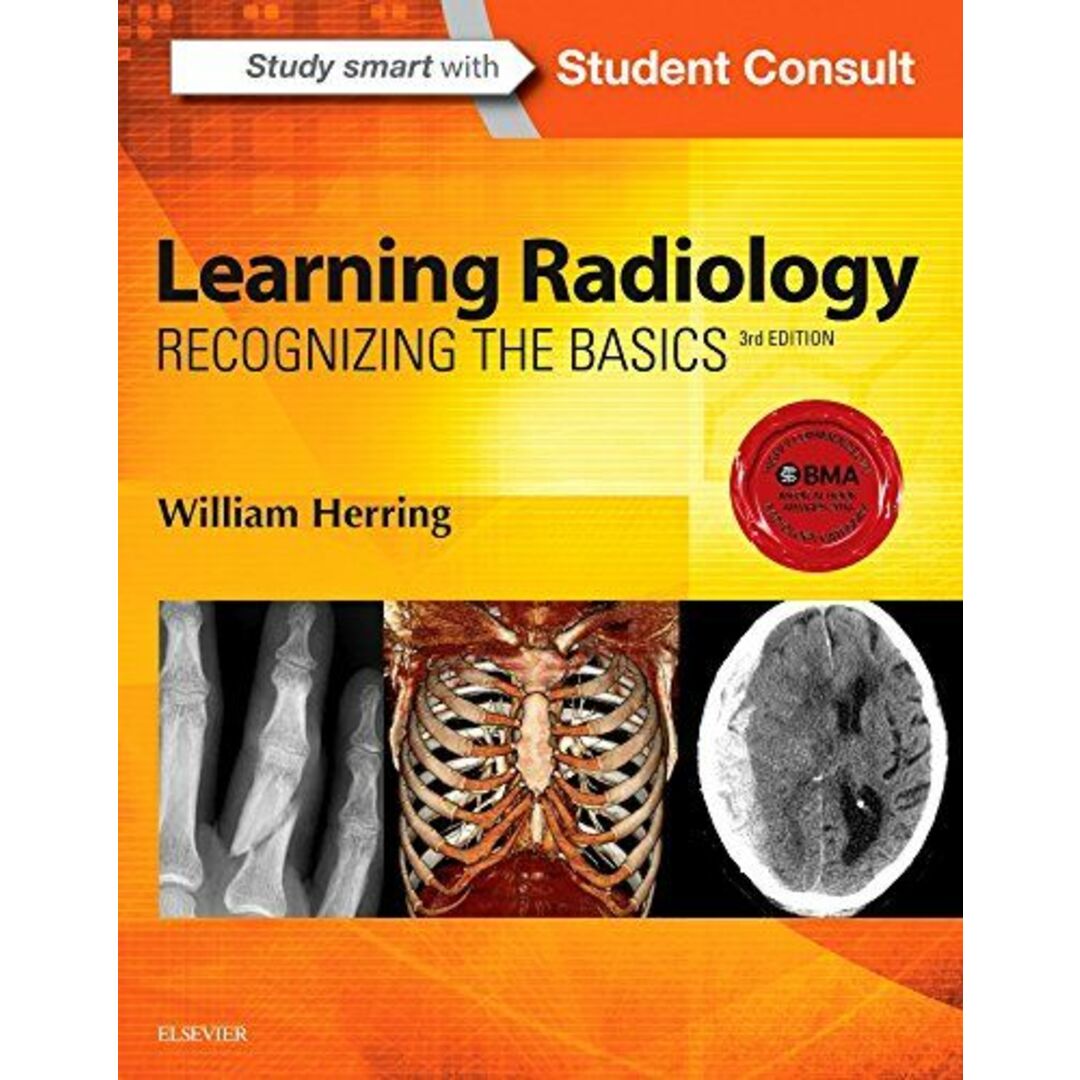 Learning Radiology: Recognizing the Basics， 3e Herring MD  FACR， William エンタメ/ホビーの本(語学/参考書)の商品写真