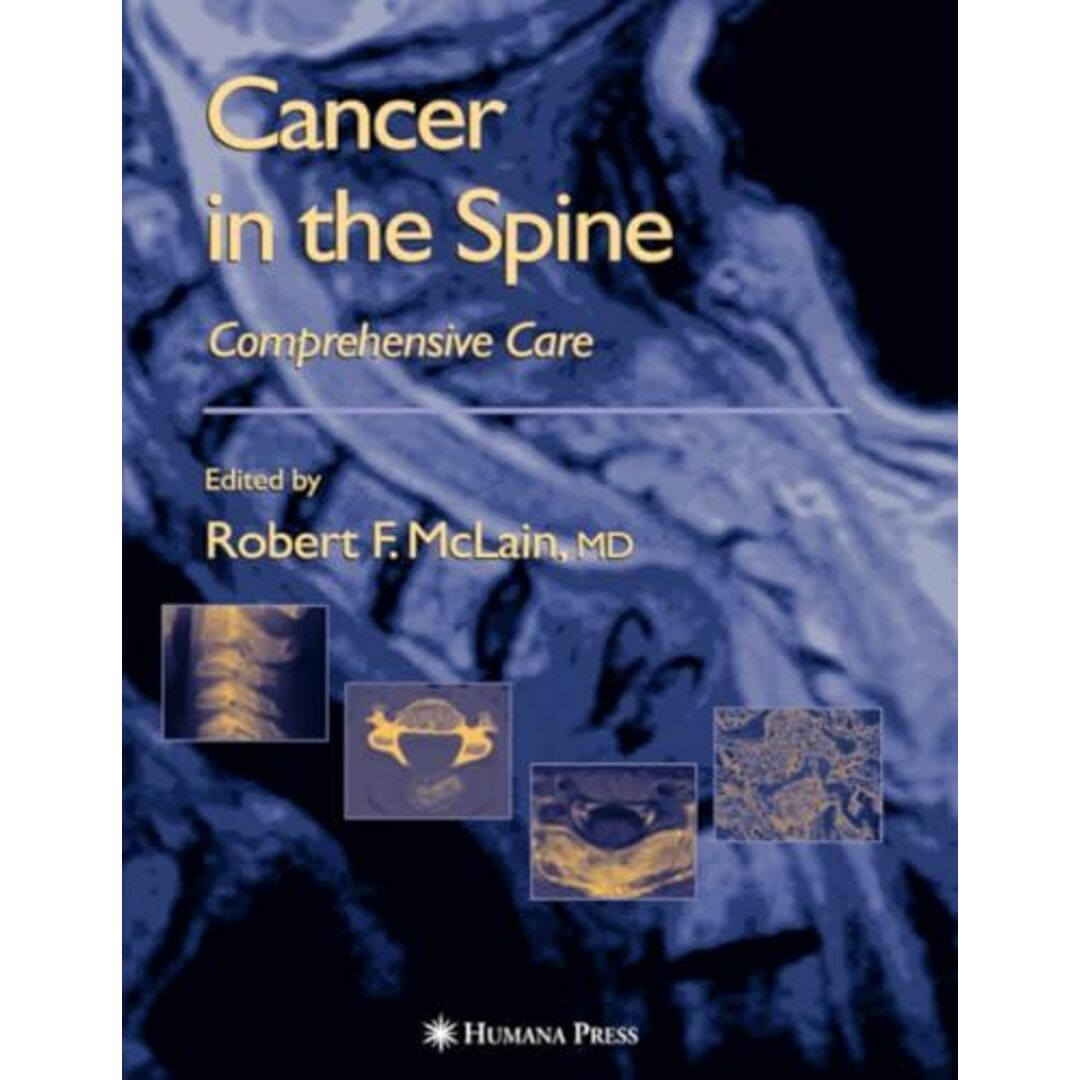 Cancer in the Spine: Comprehensive Care (Current Clinical Oncology) [ペーパーバック] various， .、 McLain， Robert F.、 Markman， Maurie、 Bukowski， Ronald M.、 Macklis， Roger; Benzel， Edward C.ブックスドリーム出品一覧旺文社