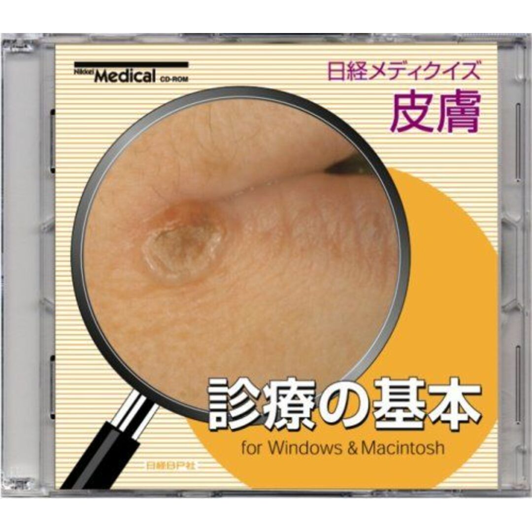 日経メディクイズ 皮膚 診療の基本 CD-ROM (＜CDーROM＞(HY版)) 日経メディカル; 東京慈恵会医科大学皮膚科 中川 秀己; 東海大学皮膚科 小澤 明著者