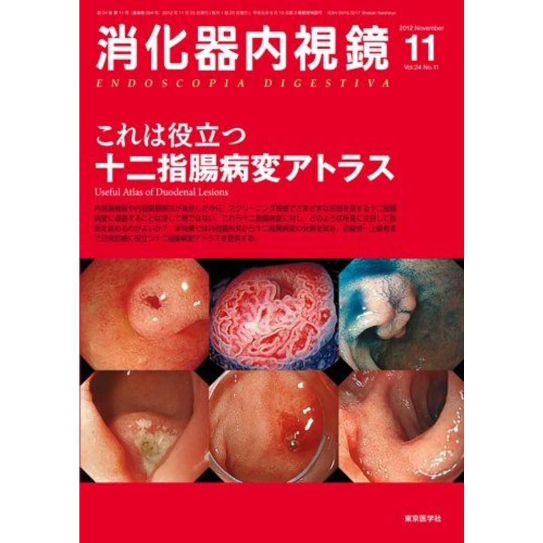 消化器内視鏡 第24巻11号 20 これは役立つ十二指腸病変アトラス (消化器内視鏡2012年11月号) 消化器内視鏡編集委員会ISBN10