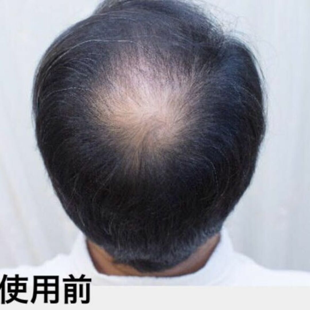 薄毛増毛ふりかけパウダー詰め替え用抜け毛分け目白髪ハゲ隠しヘアーファンデシャドー コスメ/美容のヘアケア/スタイリング(ヘアケア)の商品写真