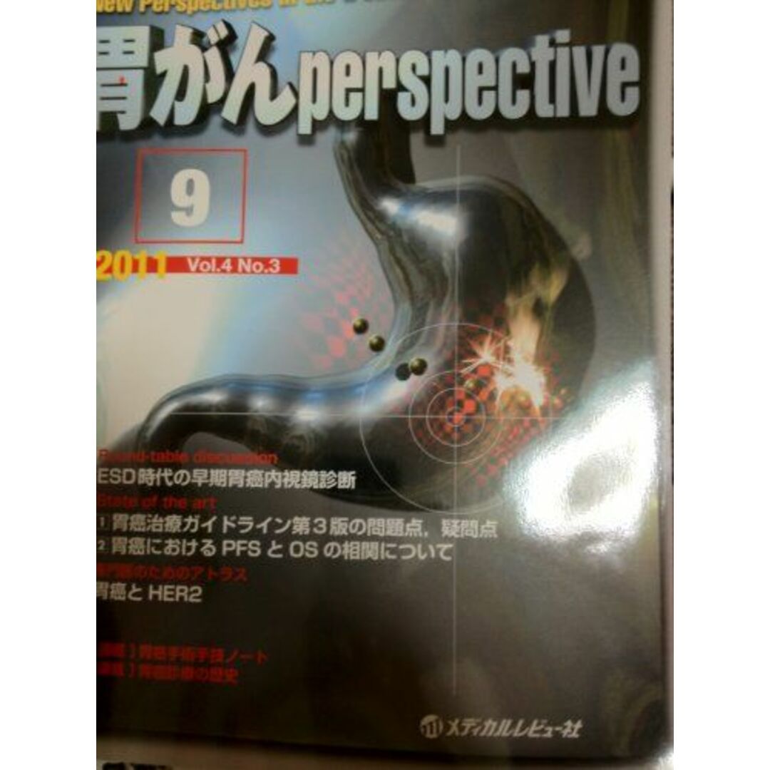 胃がんperspective 4ー3 座談会・ESD時代の早期胃癌内視鏡診断の通販