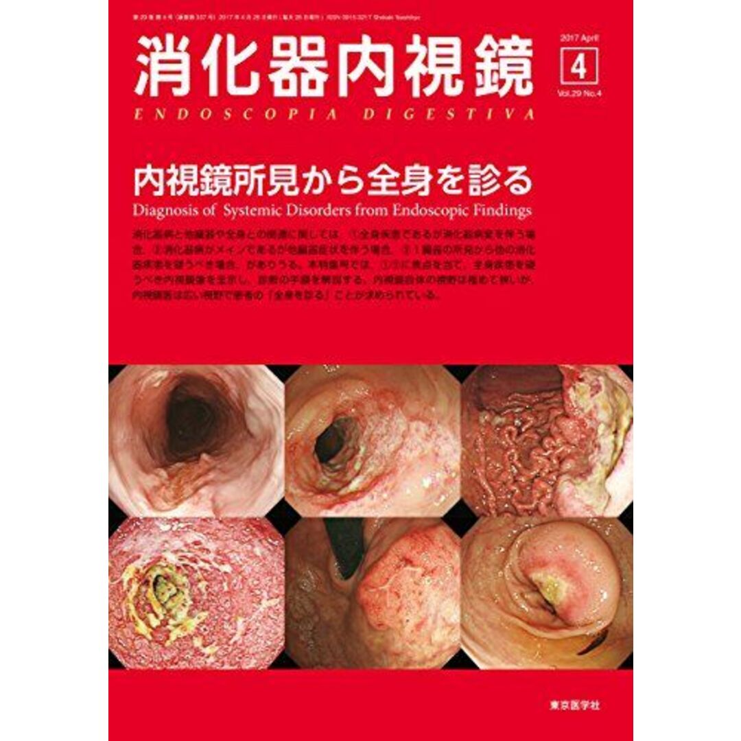 消化器内視鏡第29巻4号 内視鏡所見から全身を診る 消化器内視鏡編集委員会 エンタメ/ホビーの本(語学/参考書)の商品写真