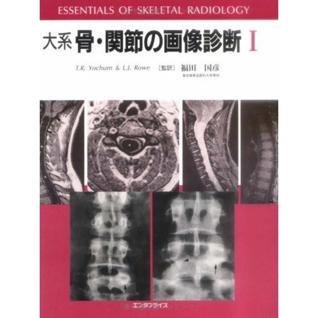 大系骨・関節の画像診断I II T.R.ヨーカム、 L.J.ロウ; 福田 国彦当社の出品一覧はこちら↓