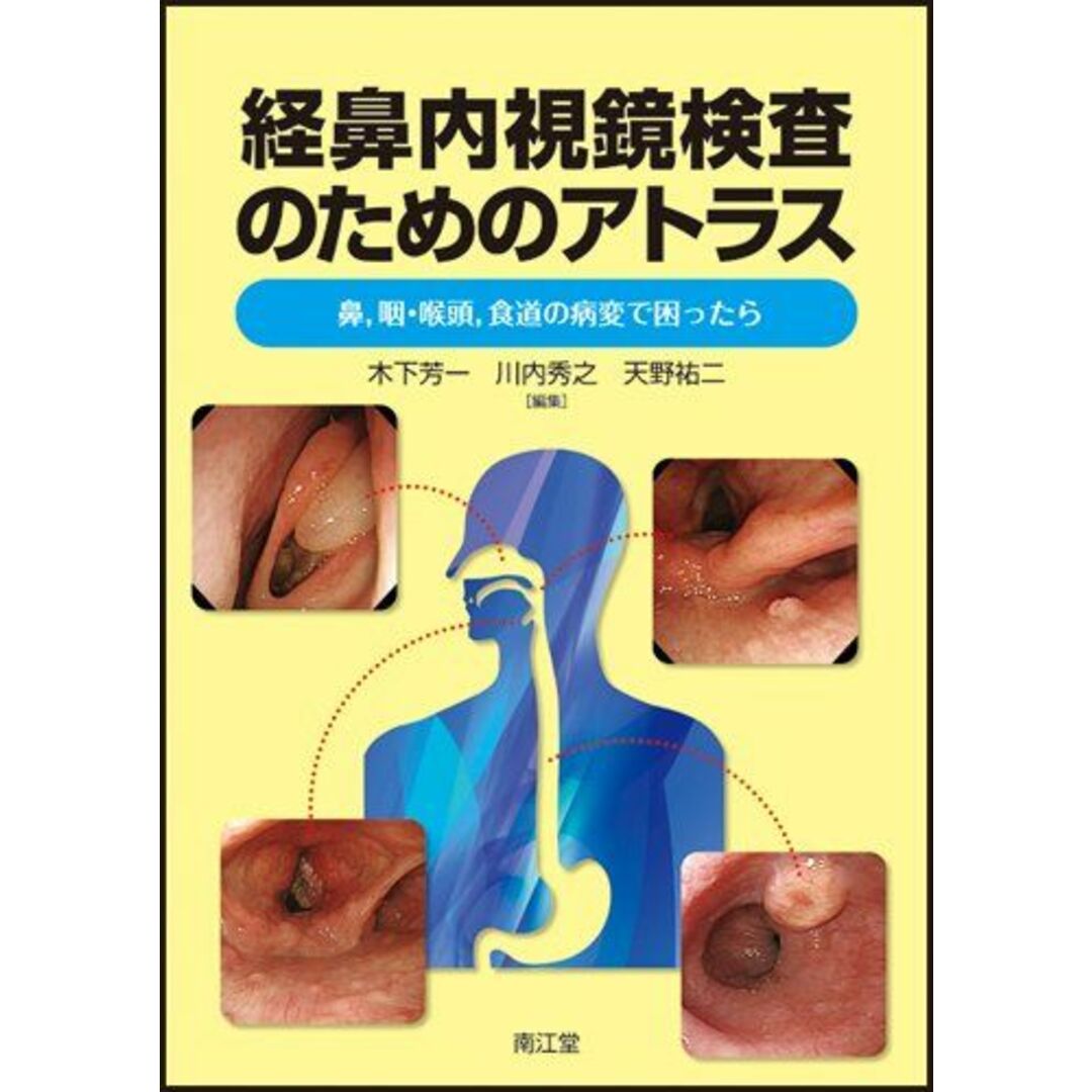 経鼻内視鏡検査のためのアトラス9784524263325