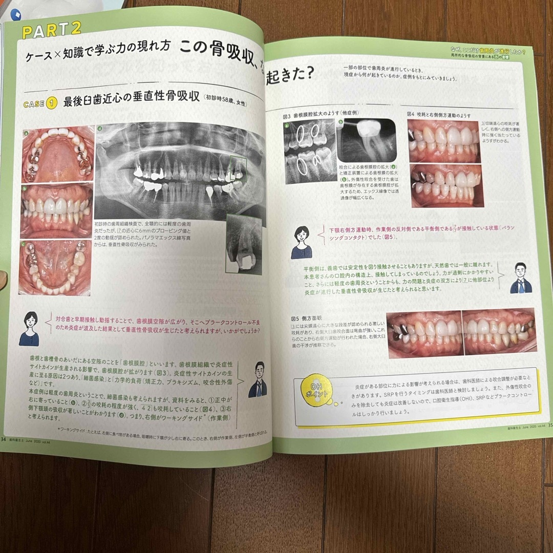 歯科衛生士　歯周炎 エンタメ/ホビーの本(語学/参考書)の商品写真