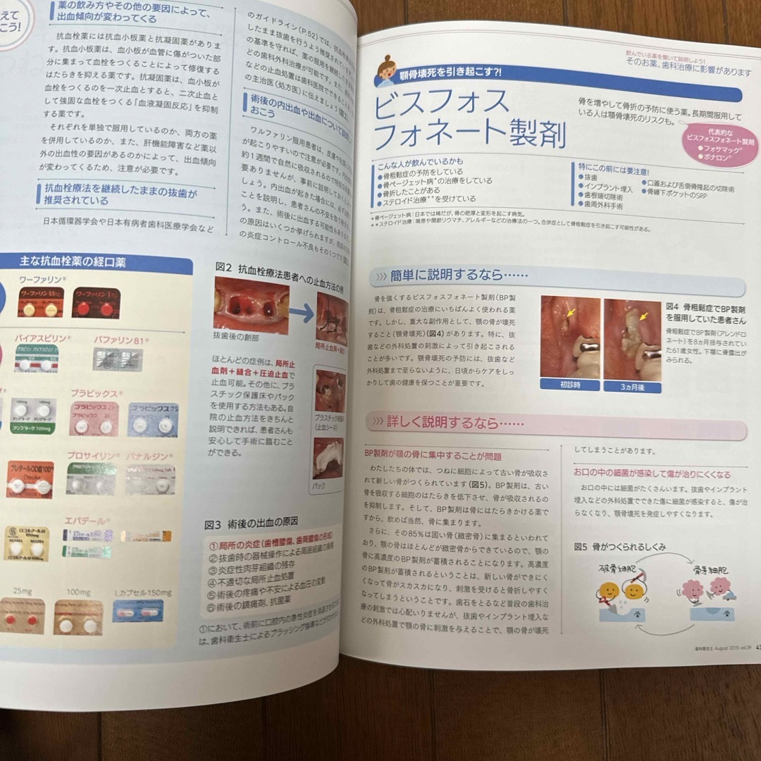 歯科衛生士　薬　フッ素 エンタメ/ホビーの本(語学/参考書)の商品写真