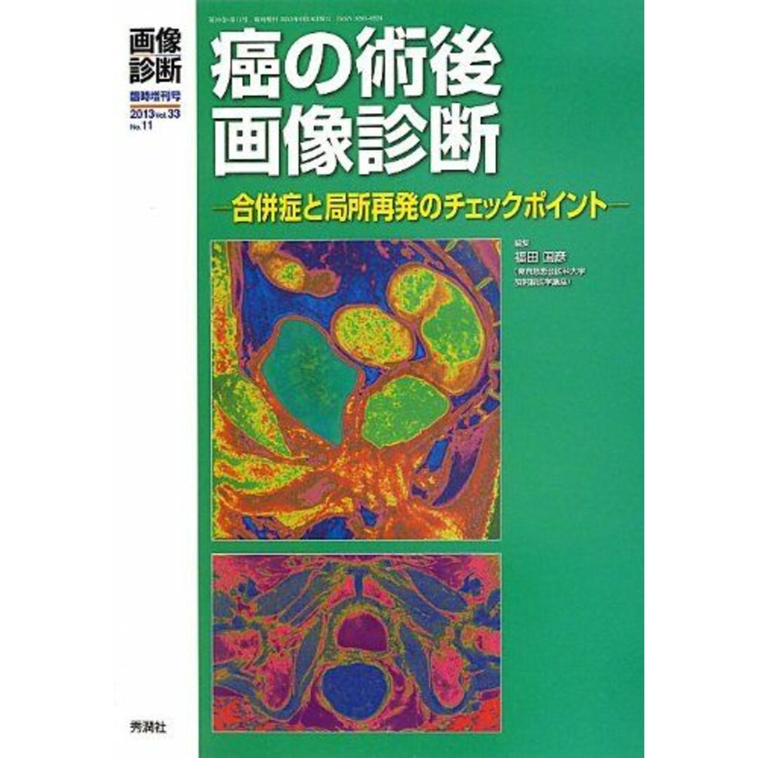 画像診断2013年9月臨時増刊号Vol.33 No.11癌の術後画像診断: 合併症と局所再発のチェックポイント 福田国彦 エンタメ/ホビーの本(語学/参考書)の商品写真