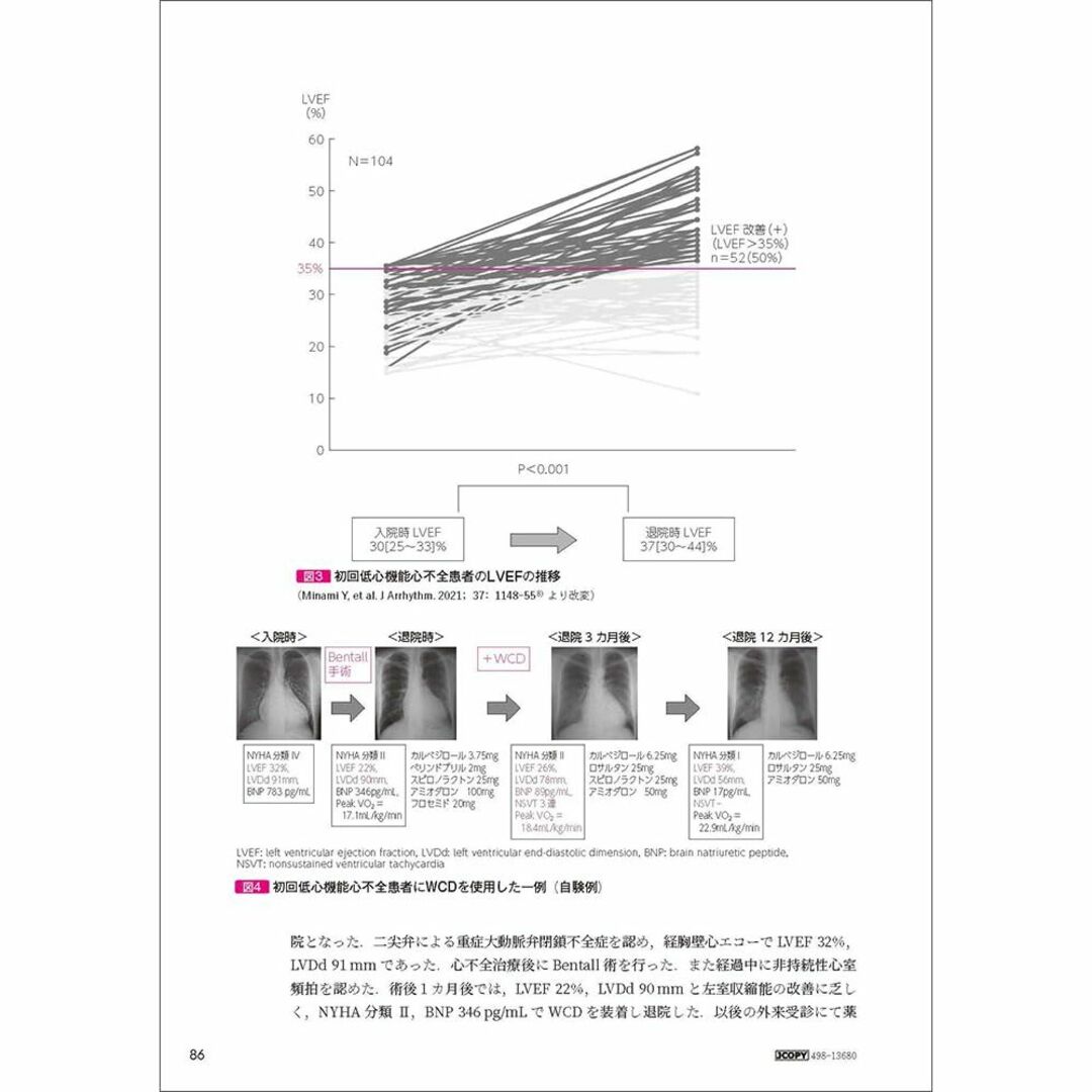 心不全診療Controversy エンタメ/ホビーの本(健康/医学)の商品写真