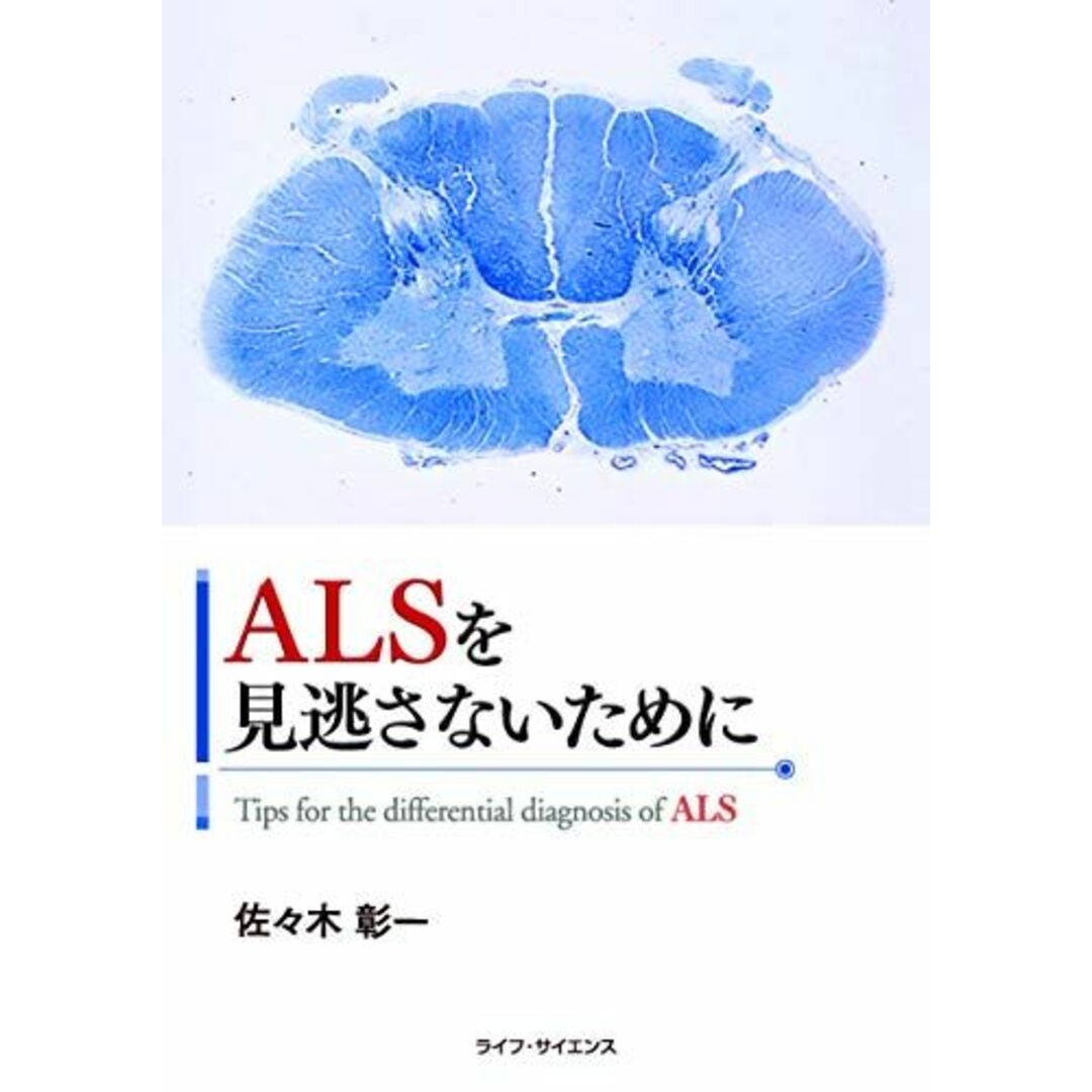 ALSを見逃さないために 佐々木 彰一 エンタメ/ホビーの本(語学/参考書)の商品写真