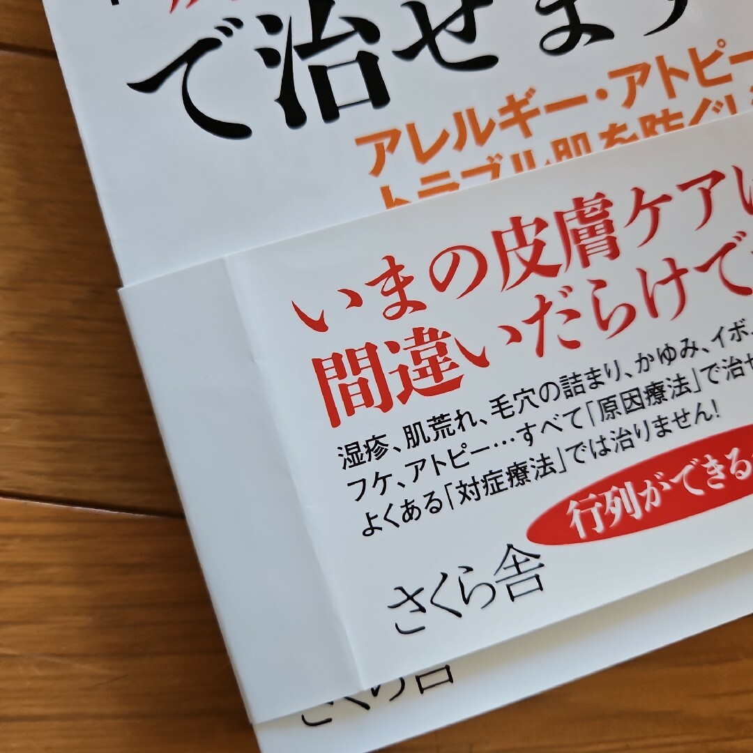 アトピー関連の本　本　まとめ売り　アトピー エンタメ/ホビーの本(健康/医学)の商品写真