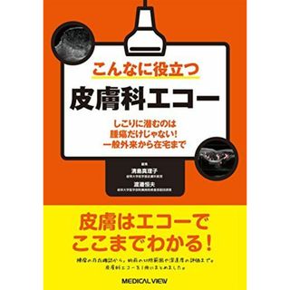 こんなに役立つ皮膚科エコー?しこりに潜むのは腫瘍だけじゃない! 一般外来から在宅まで 清島 真理子; 渡邉 恒夫(語学/参考書)