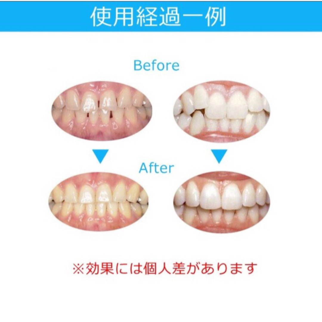 大人気◆最安値◆ マウスピース  矯正 歯ぎしり対策◆ブルー色 コスメ/美容のオーラルケア(その他)の商品写真