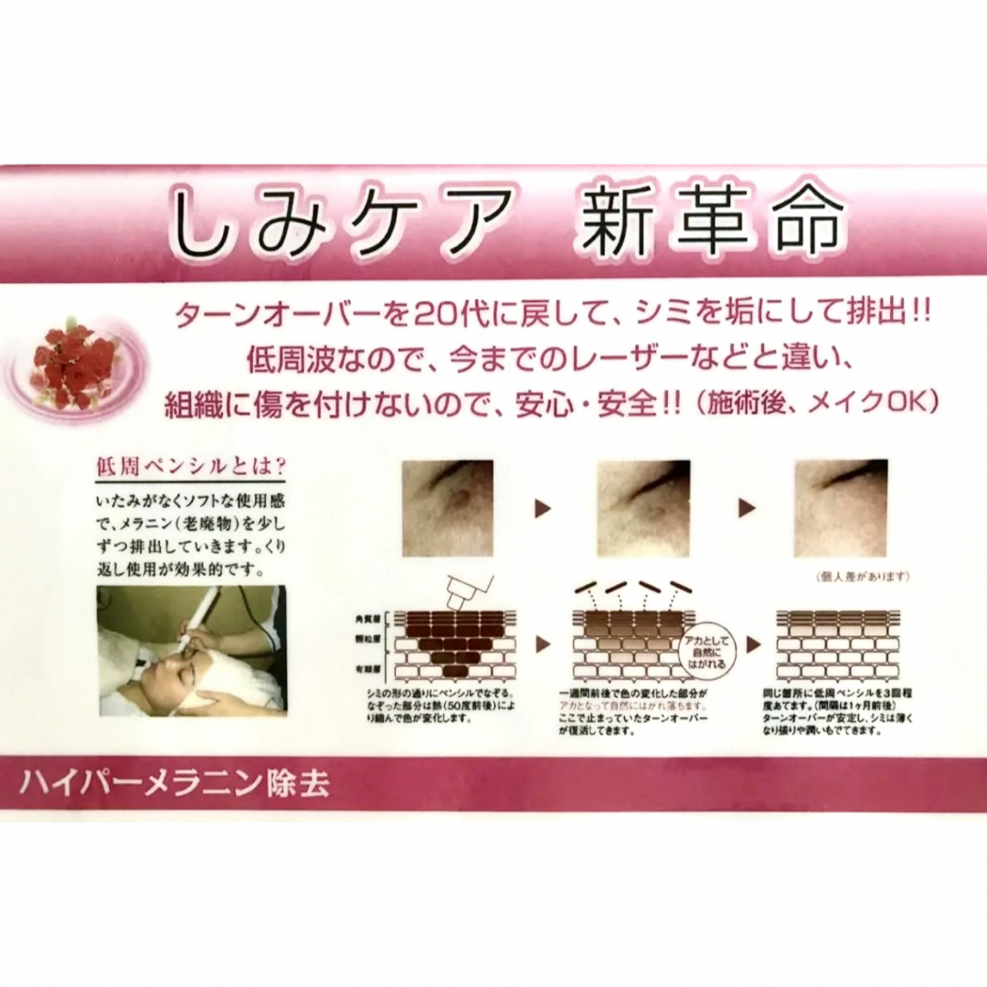 4月5日まで専用 ゼロサイエンス ゼロデトックス シミ取り 4月5日まで専用 ゼロサイエンス ゼロデトックス シミ取り