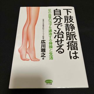 下肢静脈瘤は自分で治せる(健康/医学)