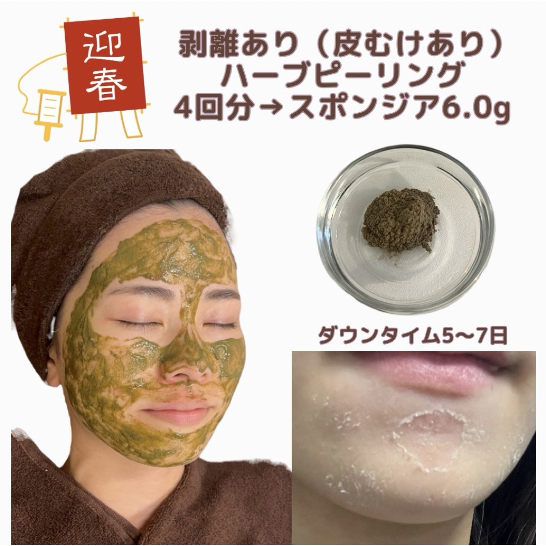 新春キャンペーン】剥離ありハーブピーリング4回分 新春キャンペーン】剥離ありハーブピーリング4回分