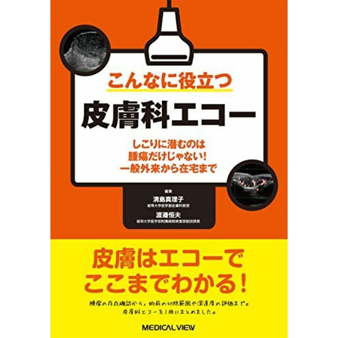 こんなに役立つ皮膚科エコー?しこりに潜むのは腫瘍だけじゃない! 一般外来から在宅まで 清島 真理子; 渡邉 恒夫 エンタメ/ホビーの本(語学/参考書)の商品写真