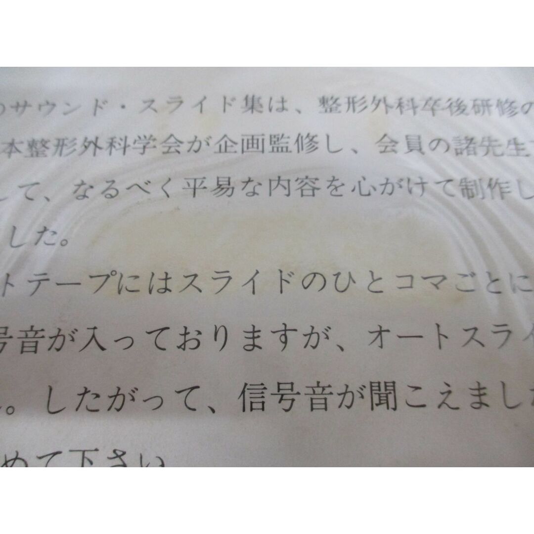 ▲01)【同梱不可】日本整形外科学会卒後研修用 サウンド・スライド集 第15巻/ペルテス病の病態と治療/西尾篤人/医学用フィルム/カセット/A ▲01)【同梱不可】日本整形外科学会卒後研修用 サウンド・スライド集 第15巻/ペルテス病の病態と治療/西尾篤人/医学用フィルム/カセット/A