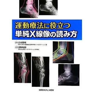 運動療法に役立つ単純Ｘ線像の読み方／青木隆明【編】，浅野昭裕【著】