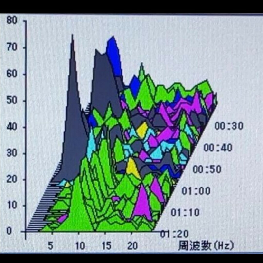 ✨オフライン測定可！PCに繋げるだけ✨脳波測定器 アルファテック4s コスメ/美容のリラクゼーション(その他)の商品写真