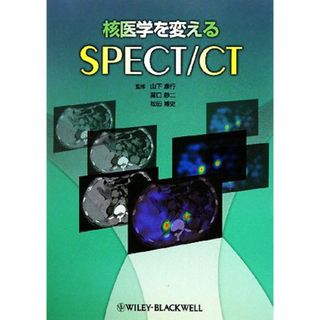 核医学を変えるＳＰＥＣＴ／ＣＴ／山下康行，冨口静二，松田博史【監修】(健康/医学)