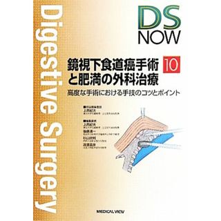 鏡視下食道癌手術と肥満の外科治療 高度な手術における手技のコツとポイント Ｄｉｇｅｓｔｉｖｅ　Ｓｕｒｇｅｒｙ　ＮＯＷＮｏ．１０／上西紀夫【担当編集委員】(健康/医学)