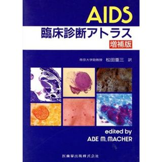 ＡＩＤＳ臨床診断アトラス　増補版／松田重三(著者)(健康/医学)