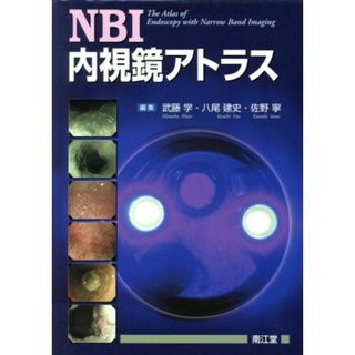 ＮＢＩ内視鏡アトラス／武藤学(著者)(健康/医学)