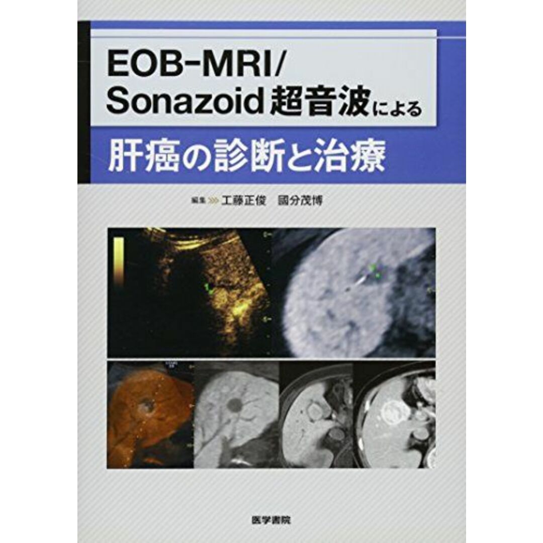 EOB-MRI/Sonazoid 超音波による肝癌の診断と治療 [単行本] 正俊，工藤; 茂博，國分 エンタメ/ホビーの本(語学/参考書)の商品写真