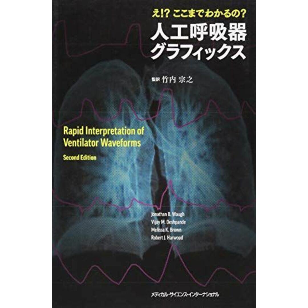 え!?ここまでわかるの？人工呼吸器グラフィックス エンタメ/ホビーの本(語学/参考書)の商品写真