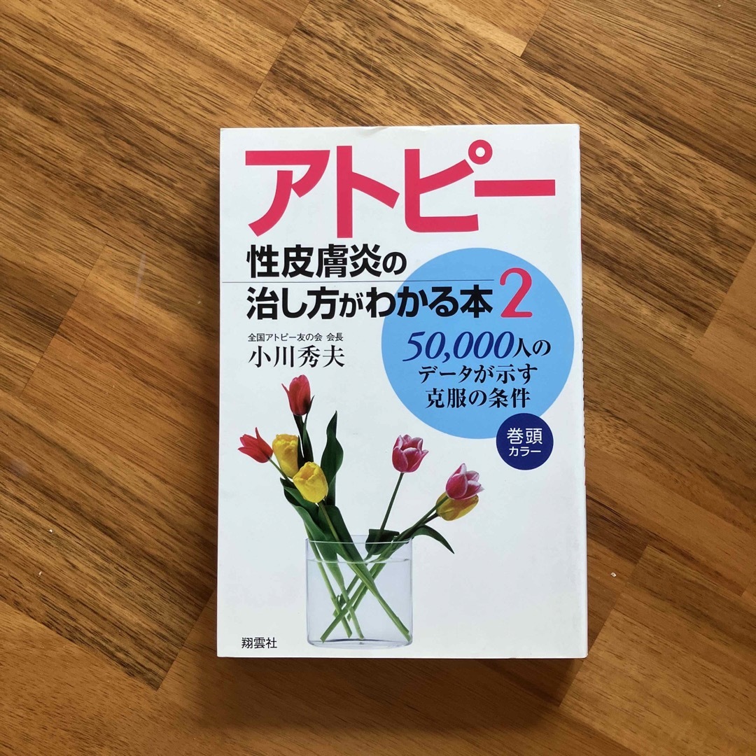 アトピー性皮膚炎の治し方がわかる本 : 50,000人のデータが示す克服の条件… エンタメ/ホビーの本(健康/医学)の商品写真