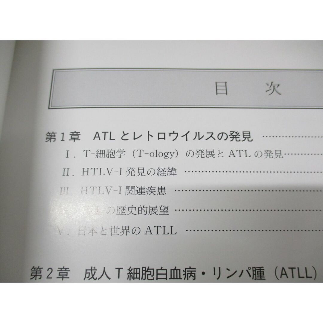 ●01)【同梱不可】成人T細胞 白血病・リンパ腫/木下研一郎/新興医学出版社/2003年発行/A エンタメ/ホビーの本(健康/医学)の商品写真