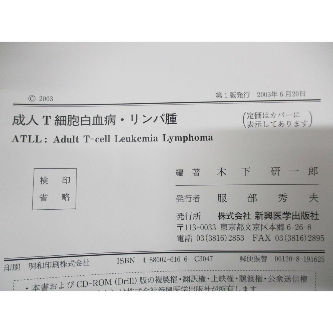 ●01)【同梱不可】成人T細胞 白血病・リンパ腫/木下研一郎/新興医学出版社/2003年発行/A エンタメ/ホビーの本(健康/医学)の商品写真