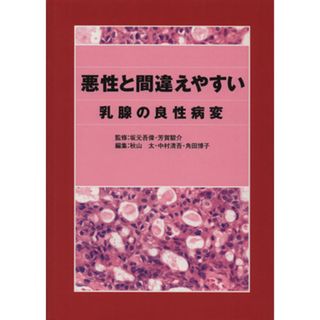 悪性と間違えやすい乳腺の良性病変／秋山太(著者),中村清吾(著者)(健康/医学)