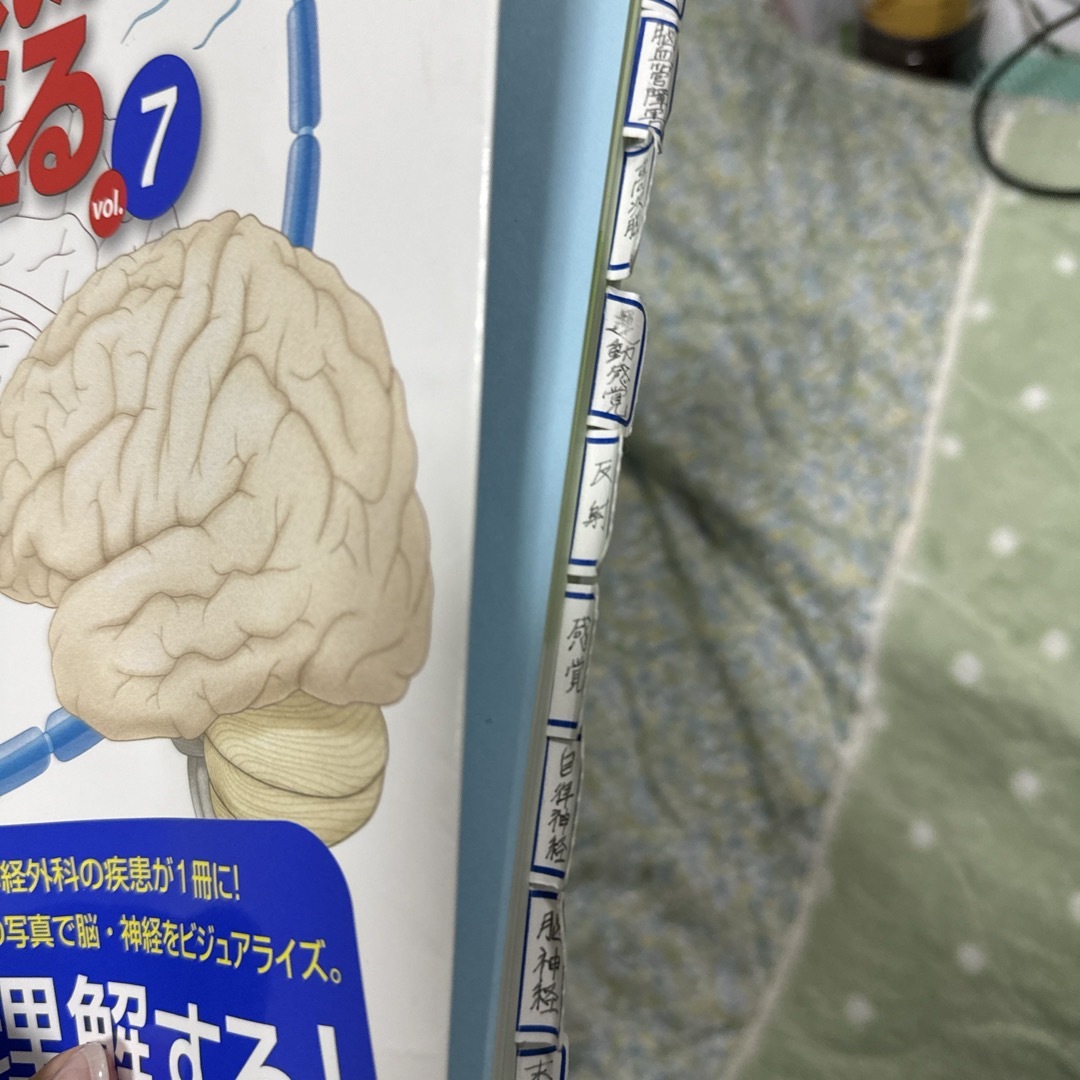 病気がみえる　vol.7 脳・神経 エンタメ/ホビーの本(語学/参考書)の商品写真