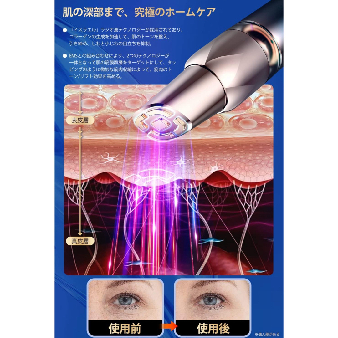 目元美顔器　3 in 1 目元ケア　RF美顔器　引き締め スマホ/家電/カメラの美容/健康(フェイスケア/美顔器)の商品写真