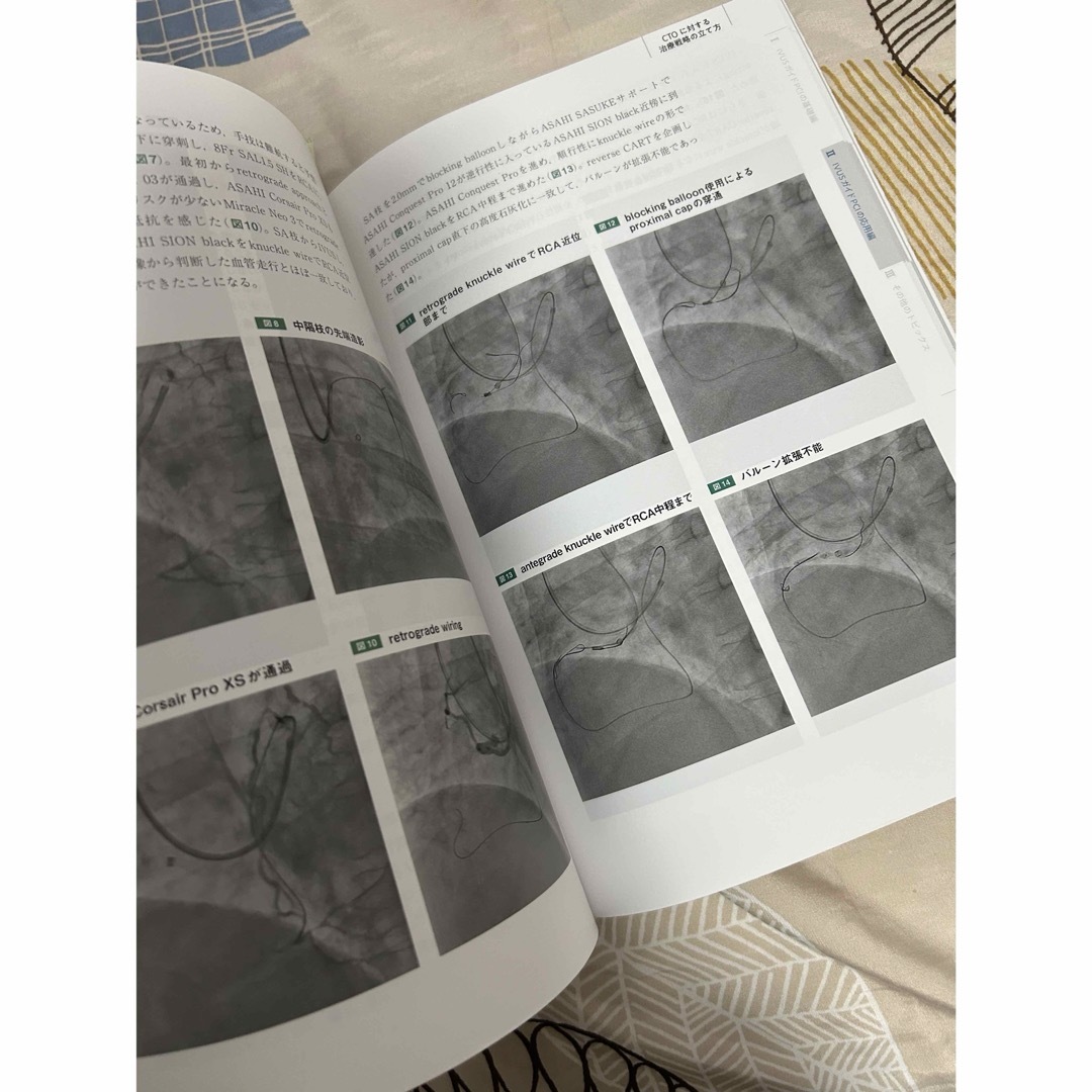 IVUS 心臓カテーテル　心カテ エンタメ/ホビーの本(健康/医学)の商品写真