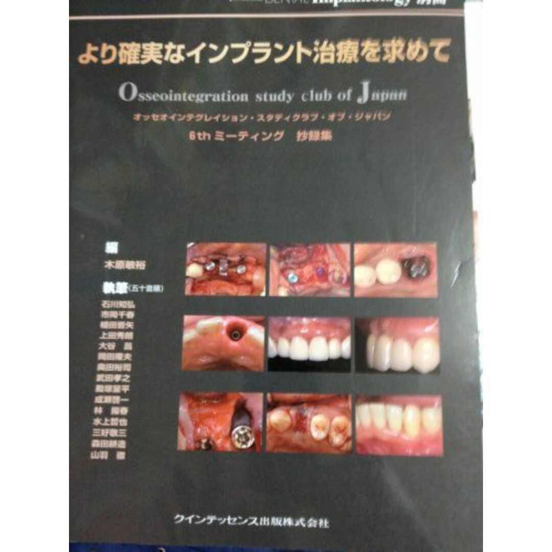 全信頼を寄せる より確実なインプラント治療を求めて―オッセオインテグ 歯科学