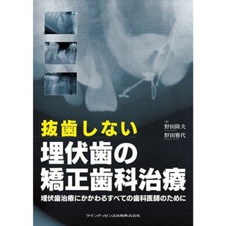 抜歯しない埋伏歯の矯正歯科治療(語学/参考書)