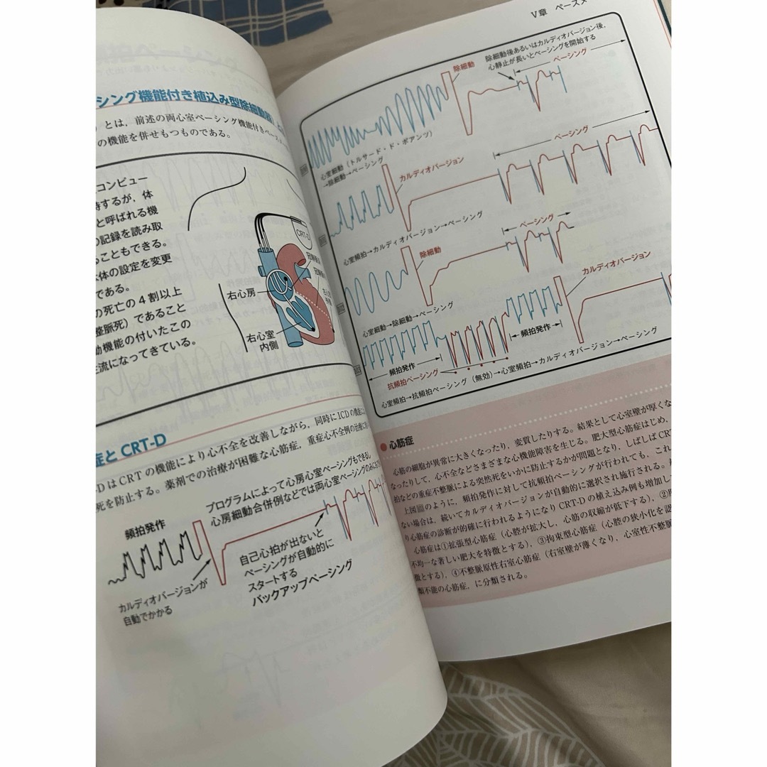 心電図　心電図モニター　定価2300円 エンタメ/ホビーの本(健康/医学)の商品写真