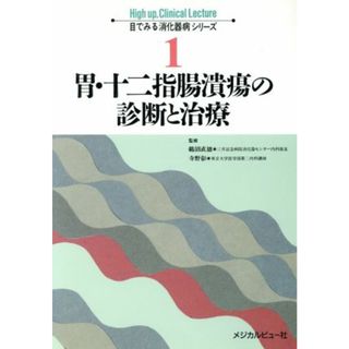 胃・十二指腸潰瘍の診断と治療 目でみる消化器病シリーズ１／消化器・循環器病(健康/医学)